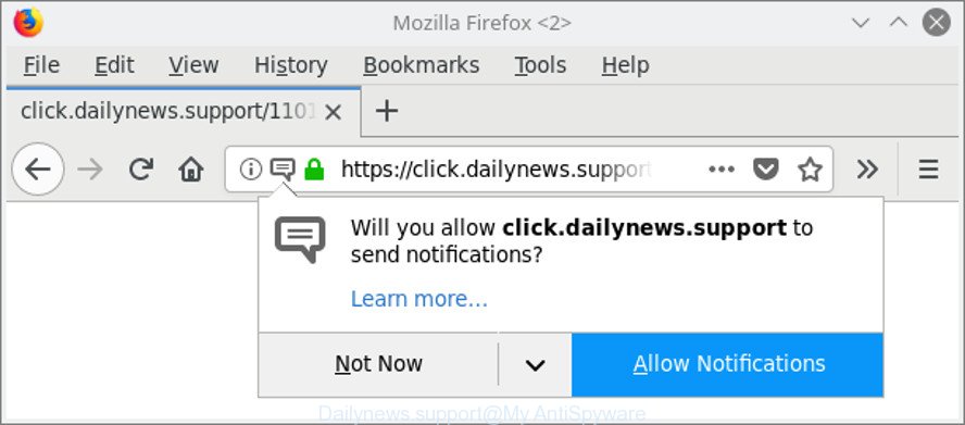 Dailynews.support